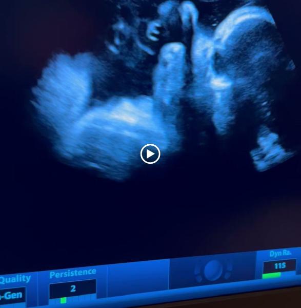 Pregnancy Treasures & Boutique (3d4d5d Ultrasound)